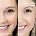 Before and After