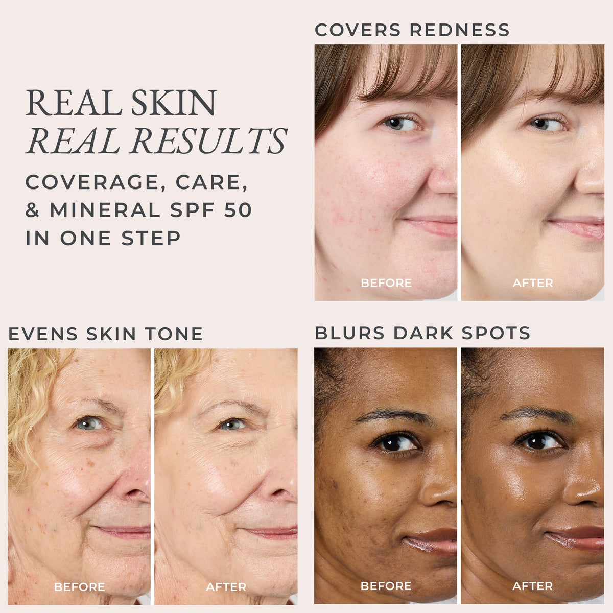 Collage showing before and after results of 4-in-1 Skin Tint SPF 50 on redness, even skin tone, and dark spots.
