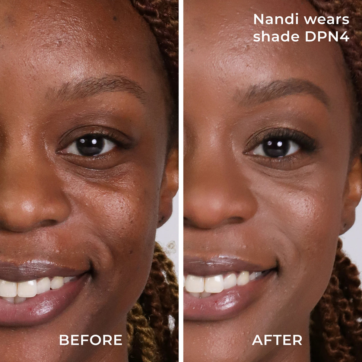 Before and after results DPN4 