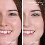 Before and after results with LP4 powder foundation 