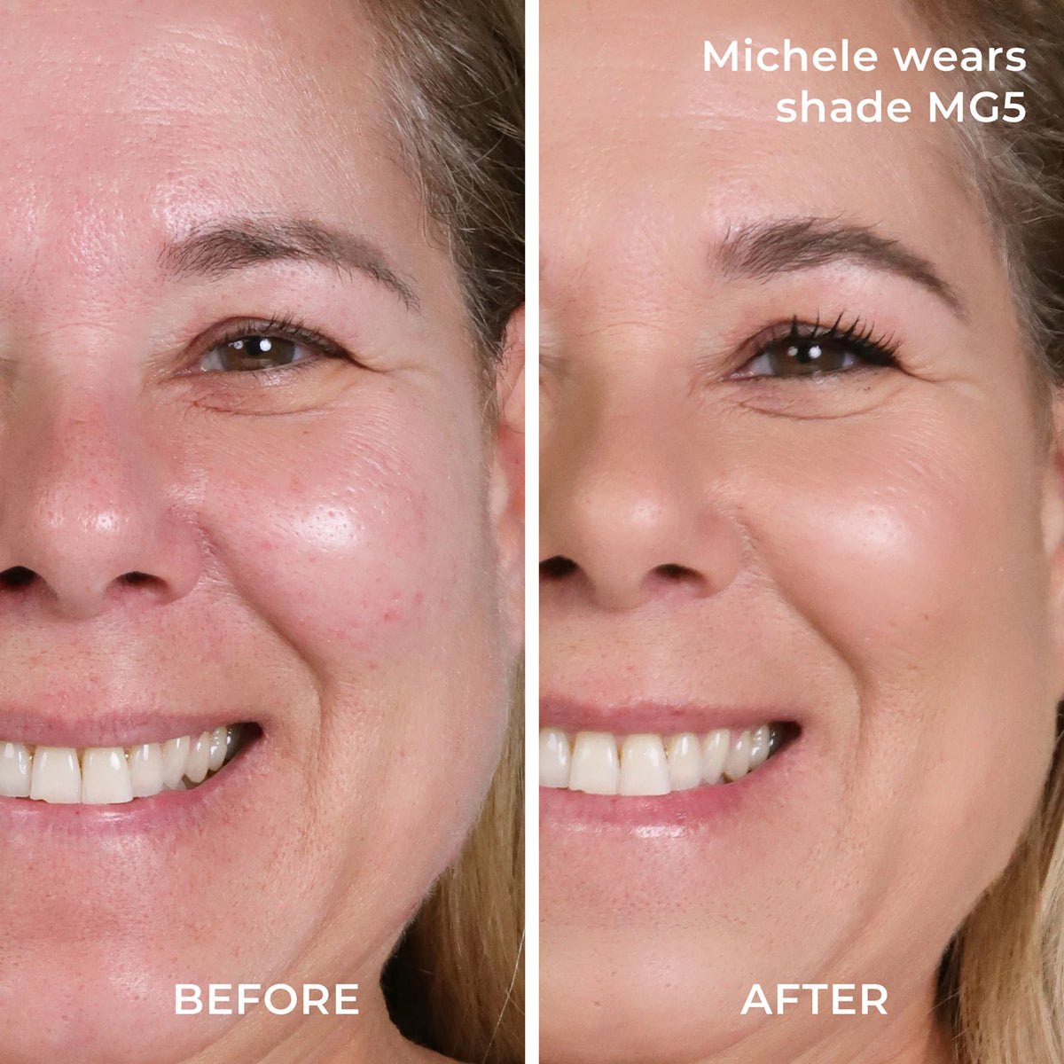 Before and after results MG5 