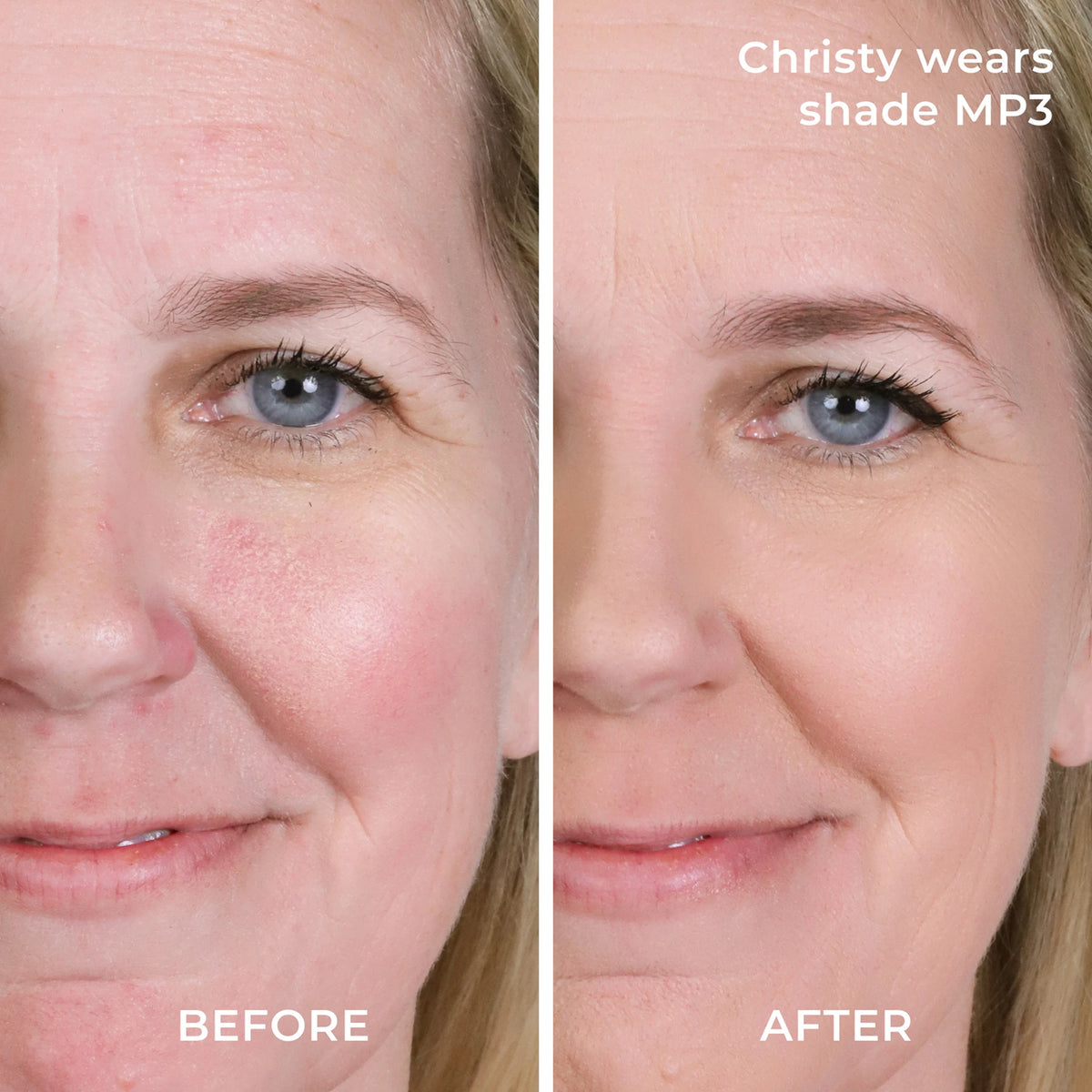 Before and after results MP3 