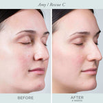 Rescue C Brightening Vitamin C & Peptide Eye Cream - PÜR Beauty